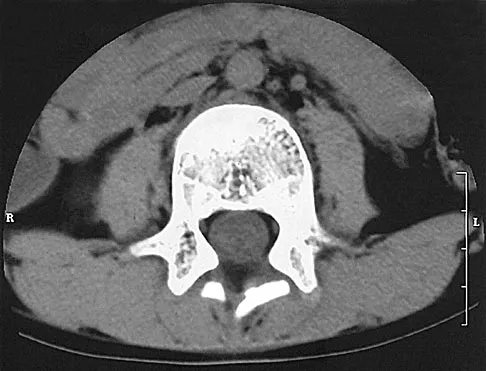 Pediatrics Board Review 2004: High-Yield MCQs (Set 4) - Figure 10