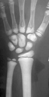 Pediatrics Board Review 2004: High-Yield MCQs (Set 4) - Figure 15