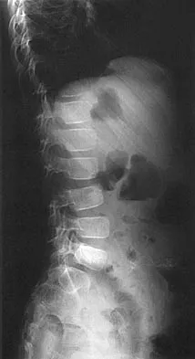 Pediatrics Board Review 2004: High-Yield MCQs (Set 4) - Figure 9