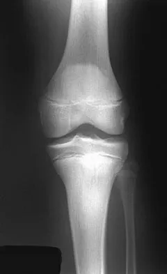 Pediatrics 2007 Practice Questions: Set 1 (Solved) - Figure 1
