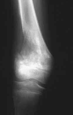Pediatrics 2007 Practice Questions: Set 1 (Solved) - Figure 11