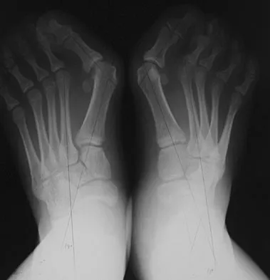 Pediatrics 2007 Practice Questions: Set 1 (Solved) - Figure 14