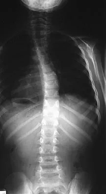 Pediatrics 2007 Practice Questions: Set 1 (Solved) - Figure 17