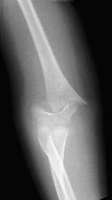 Pediatrics 2007 Practice Questions: Set 1 (Solved) - Figure 18