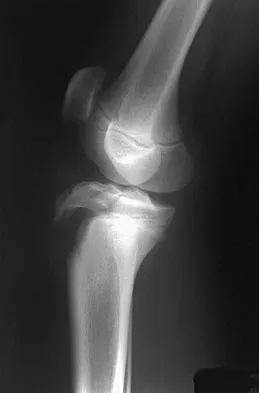 Pediatrics 2007 Practice Questions: Set 1 (Solved) - Figure 3