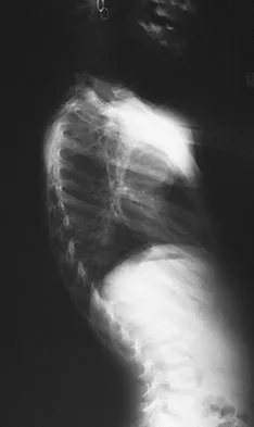 Pediatrics Board Review 2007: High-Yield MCQs (Set 2) - Figure 14