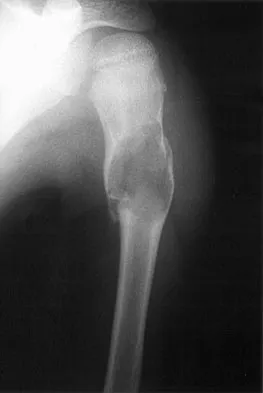 Pediatrics Board Review 2007: High-Yield MCQs (Set 2) - Figure 15