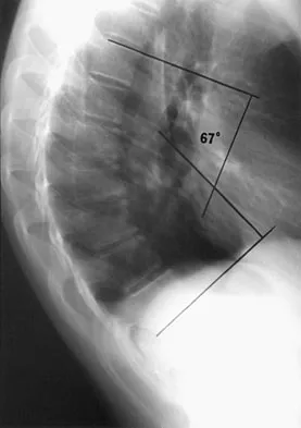 Pediatrics Board Review 2007: High-Yield MCQs (Set 2) - Figure 18