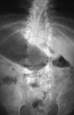 Pediatrics Board Review 2007: High-Yield MCQs (Set 2) - Figure 22