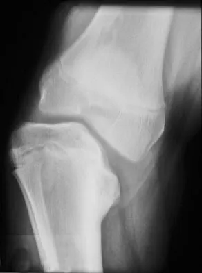 Pediatrics Board Review 2007: High-Yield MCQs (Set 2) - Figure 4