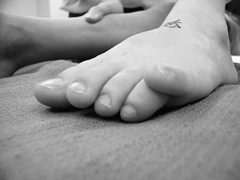 Pediatrics 2007 Practice Questions: Set 3 (Solved) - Figure 11