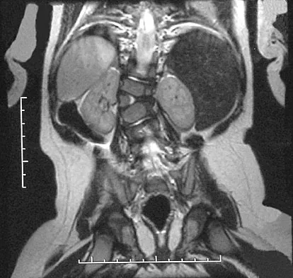 Pediatrics 2007 Practice Questions: Set 3 (Solved) - Figure 15