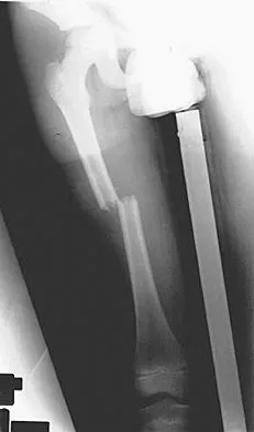 Pediatrics 2007 Practice Questions: Set 3 (Solved) - Figure 17