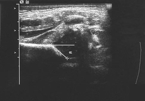 Pediatrics 2007 Practice Questions: Set 3 (Solved) - Figure 3