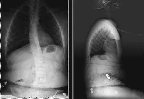 Pediatrics 2007 Practice Questions: Set 3 (Solved) - Figure 4