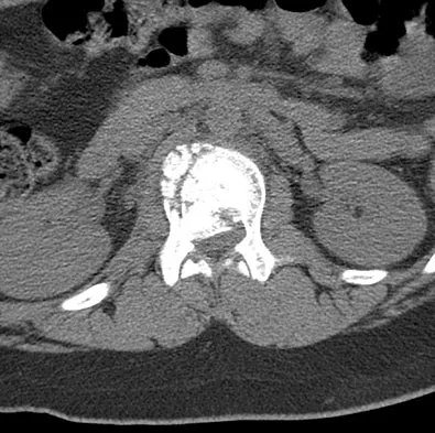 Pediatrics 2007 Practice Questions: Set 3 (Solved) - Figure 6