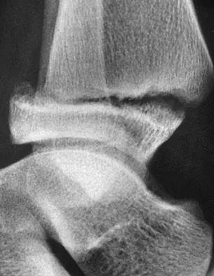 Pediatrics 2007 Practice Questions: Set 3 (Solved) - Figure 9