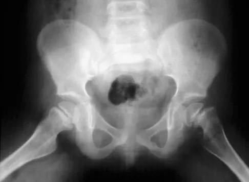 Pediatrics Board Review 2007: High-Yield MCQs (Set 4) - Figure 11