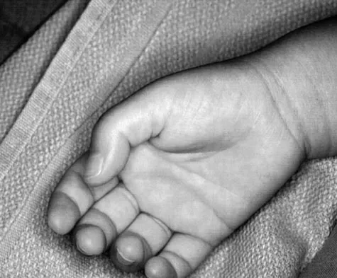 Pediatrics Board Review 2007: High-Yield MCQs (Set 4) - Figure 14