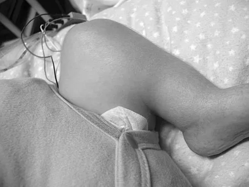 Pediatrics Board Review 2007: High-Yield MCQs (Set 4) - Figure 16