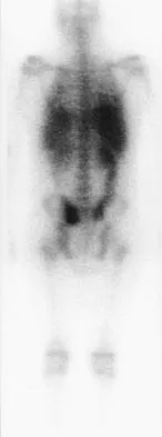 Pediatrics Board Review 2007: High-Yield MCQs (Set 4) - Figure 18