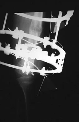 Pediatrics Board Review 2007: High-Yield MCQs (Set 4) - Figure 8