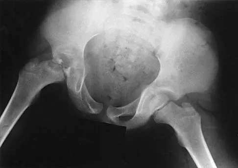 Pediatrics 2026 MCQs: Board Review Questions & Answers (Part 1) - Figure 103