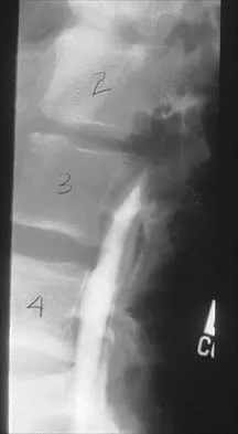 Pediatrics 2026 MCQs: Board Review Questions & Answers (Part 1) - Figure 109