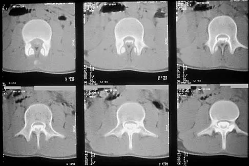 Pediatrics 2026 MCQs: Board Review Questions & Answers (Part 1) - Figure 111