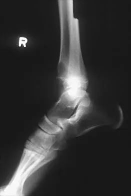 Pediatrics 2026 MCQs: Board Review Questions & Answers (Part 1) - Figure 151