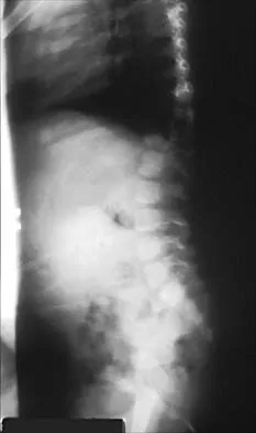 Pediatrics 2026 MCQs: Board Review Questions & Answers (Part 1) - Figure 165