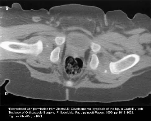 Pediatrics 2026 MCQs: Board Review Questions & Answers (Part 1) - Figure 171
