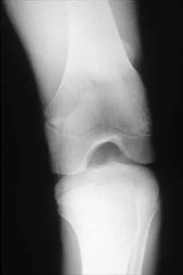 Pediatrics 2026 MCQs: Board Review Questions & Answers (Part 1) - Figure 173