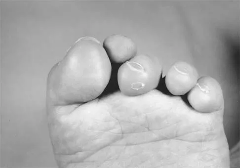 Pediatrics 2026 MCQs: Board Review Questions & Answers (Part 1) - Figure 177