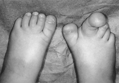 Pediatrics 2026 MCQs: Board Review Questions & Answers (Part 1) - Figure 193