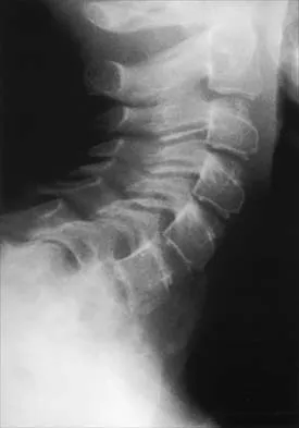 Pediatrics 2026 MCQs: Board Review Questions & Answers (Part 1) - Figure 215