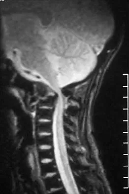Pediatrics 2026 MCQs: Board Review Questions & Answers (Part 1) - Figure 22