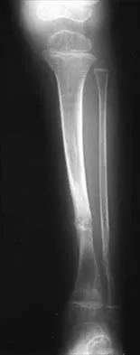 Pediatrics 2026 MCQs: Board Review Questions & Answers (Part 1) - Figure 249