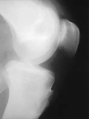 Pediatrics 2026 MCQs: Board Review Questions & Answers (Part 1) - Figure 255