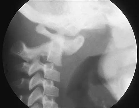 Pediatrics 2026 MCQs: Board Review Questions & Answers (Part 1) - Figure 259