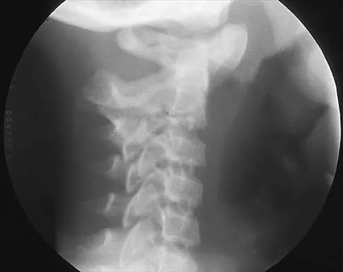 Pediatrics 2026 MCQs: Board Review Questions & Answers (Part 1) - Figure 261