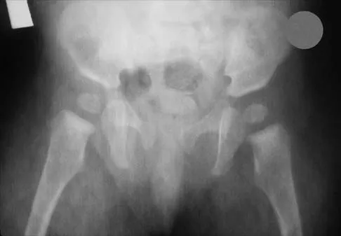 Pediatrics 2026 MCQs: Board Review Questions & Answers (Part 1) - Figure 279