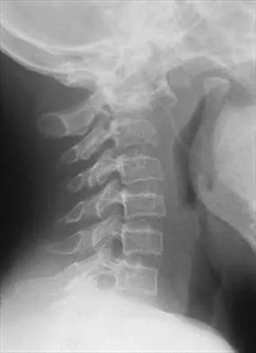 Pediatrics 2026 MCQs: Board Review Questions & Answers (Part 1) - Figure 287