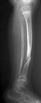 Pediatrics 2026 MCQs: Board Review Questions & Answers (Part 1) - Figure 297