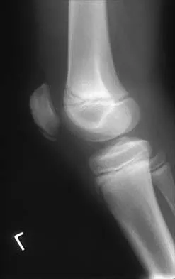 Pediatrics 2026 MCQs: Board Review Questions & Answers (Part 1) - Figure 4