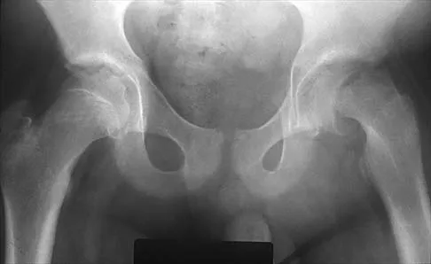 Pediatrics 2026 MCQs: Board Review Questions & Answers (Part 1) - Figure 40