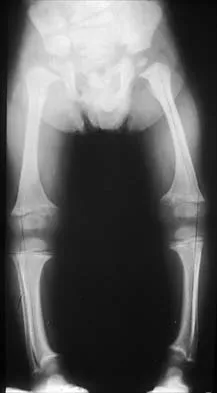 Pediatrics 2026 MCQs: Board Review Questions & Answers (Part 1) - Figure 48