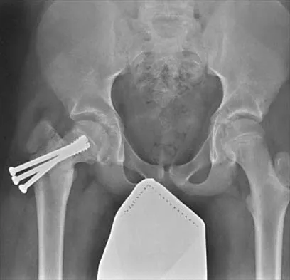 Pediatrics 2026 MCQs: Board Review Questions & Answers (Part 1) - Figure 50