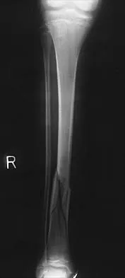 Pediatrics 2026 MCQs: Board Review Questions & Answers (Part 1) - Figure 78
