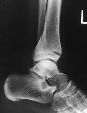 Pediatrics 2026 MCQs: Board Review Questions & Answers (Part 1) - Figure 80